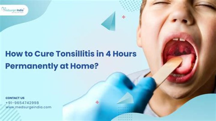 Can tonsillitis be cured permanently?