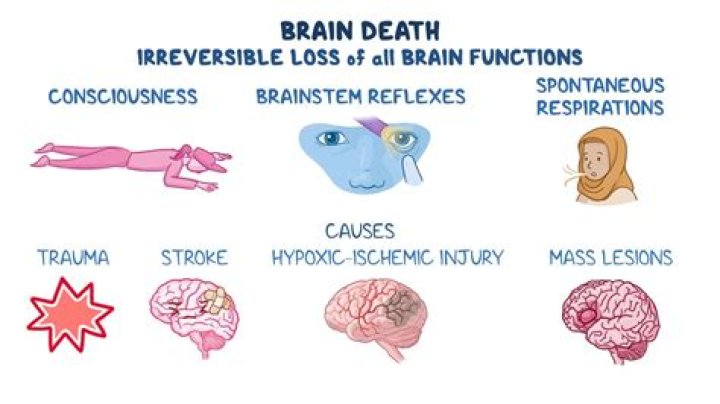 How do you determine brain stem death?