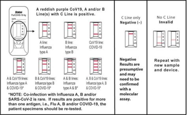 How does a rapid influenza antigen test work?