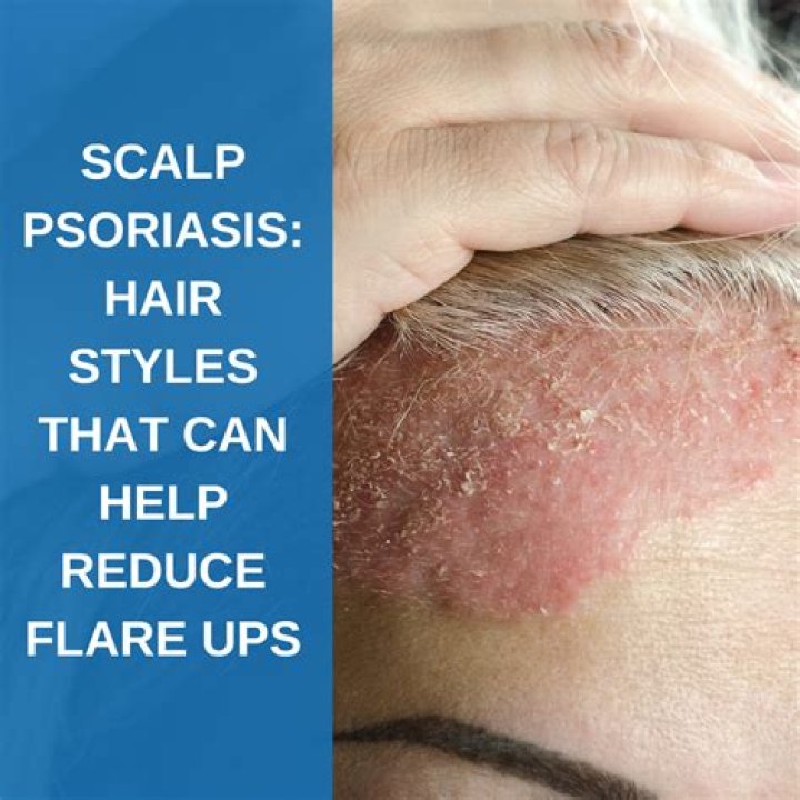 How does psoriasis affect hair?