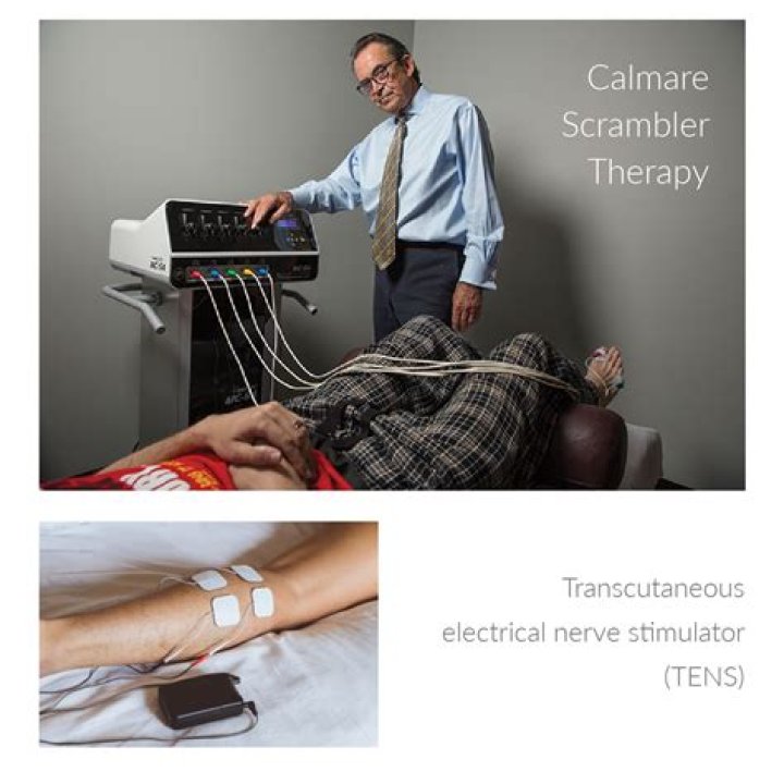 How long does Calmare therapy last?