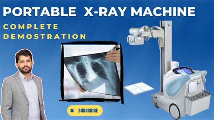 How much does a mobile x-ray machine cost?