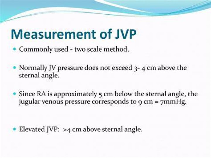 Is JVP 3 cm normal?