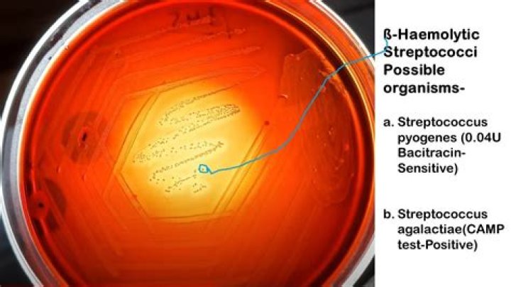 Is Streptococcus sanguinis beta hemolytic?