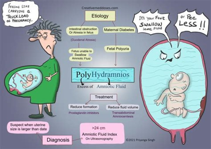 What birth defects can polyhydramnios cause?
