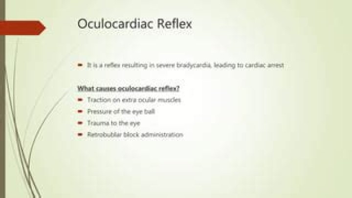 What causes Oculocardiac reflex?