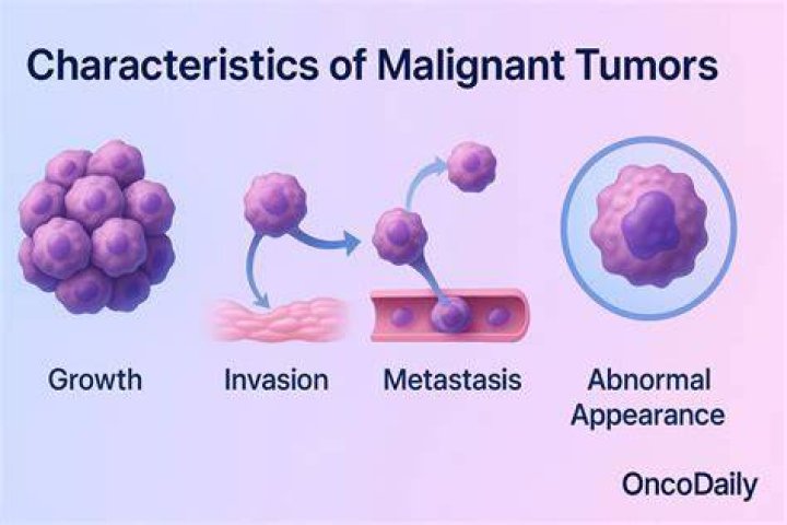 What is malignant PEComa?