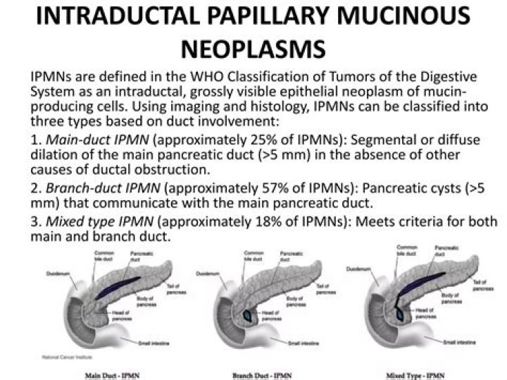 When should Ipmn be removed?
